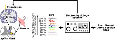 Motometrics: A Toolbox for Annotation and Efficient Analysis of Motor Evoked Potentials